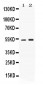 Anti-SERPINA1 Picoband Antibody