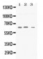Anti-Synapsin II Picoband Antibody