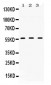 Anti-TGFBR1 Picoband Antibody