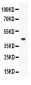 Anti-Thrombopoietin/TPO Picoband Antibody