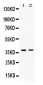 Anti-TNFRSF14/HVEM Picoband Antibody