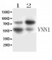 Anti-VNN1 Picoband Antibody