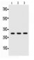 Anti-Adiponectin Picoband Antibody