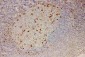 Anti-IL-18 Antibody