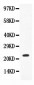 Anti-IL-18 Antibody