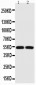 Anti-P53 Picoband Antibody