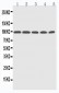 Anti-Progesterone Receptor Picoband Antibody