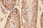 Anti-BRCA1 Picoband Antibody