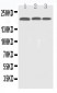 Anti-EGFR Picoband Antibody
