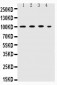 Anti-ICAM-1 Antibody