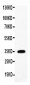 Anti-IL-1 beta Antibody