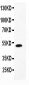 Anti-LIF Picoband Antibody