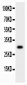 Anti-MMP-7 Antibody