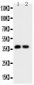 Anti-Calbindin Picoband Antibody