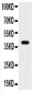 Anti-Cathepsin B Picoband Antibody