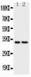 Anti-CD20 Picoband Antibody