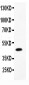 Anti-CMA1 Picoband Antibody