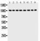 Anti-CD10/Neprilysin Antibody