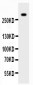 Anti-VWF Picoband Antibody