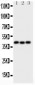 Anti-Wnt5a Picoband Antibody