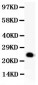 Anti-GDNF Picoband Antibody