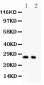 Anti-P27 KIP 1 Picoband Antibody