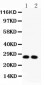 Anti-VEGF Picoband Antibody