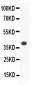 Anti-ALOX15 Picoband Antibody