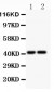 Anti-CXCR3 Picoband Antibody