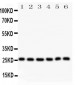 Anti-Galectin-3/LGALS3 Antibody