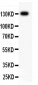 Anti-ITGB1 Picoband Antibody