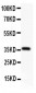 Anti-AFP Picoband Antibody