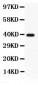 Anti-PECAM-1/CD31 Antibody