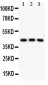 Anti-CREB Picoband Antibody