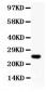 Anti-Cyclin D3 Picoband Antibody