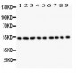 Anti-Desmin Picoband Antibody