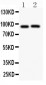 Anti-Kv2.1 Picoband Antibody