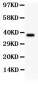 Anti-CIAS1/NALP3 Picoband Antibody