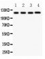 Anti-CIAS1/NALP3 Picoband Antibody