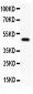 Anti-AP2 Alpha Picoband Antibody