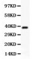 Anti-Hamartin Picoband Antibody