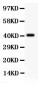 Anti-Tuberin Picoband Antibody