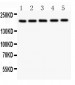 Anti-Tuberin Picoband Antibody