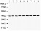 Anti-Angiopoietin-1 Antibody