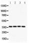 Anti-MCL1 Picoband Antibody