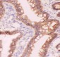 Anti-CTNNA1 Picoband Antibody