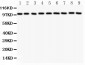 Anti-CTNNA1 Picoband Antibody