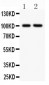 Anti-CD18 Picoband Antibody