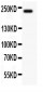 Anti-MUC4 Picoband Antibody