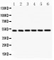 Anti-NFkB p105/P50 Picoband Antibody